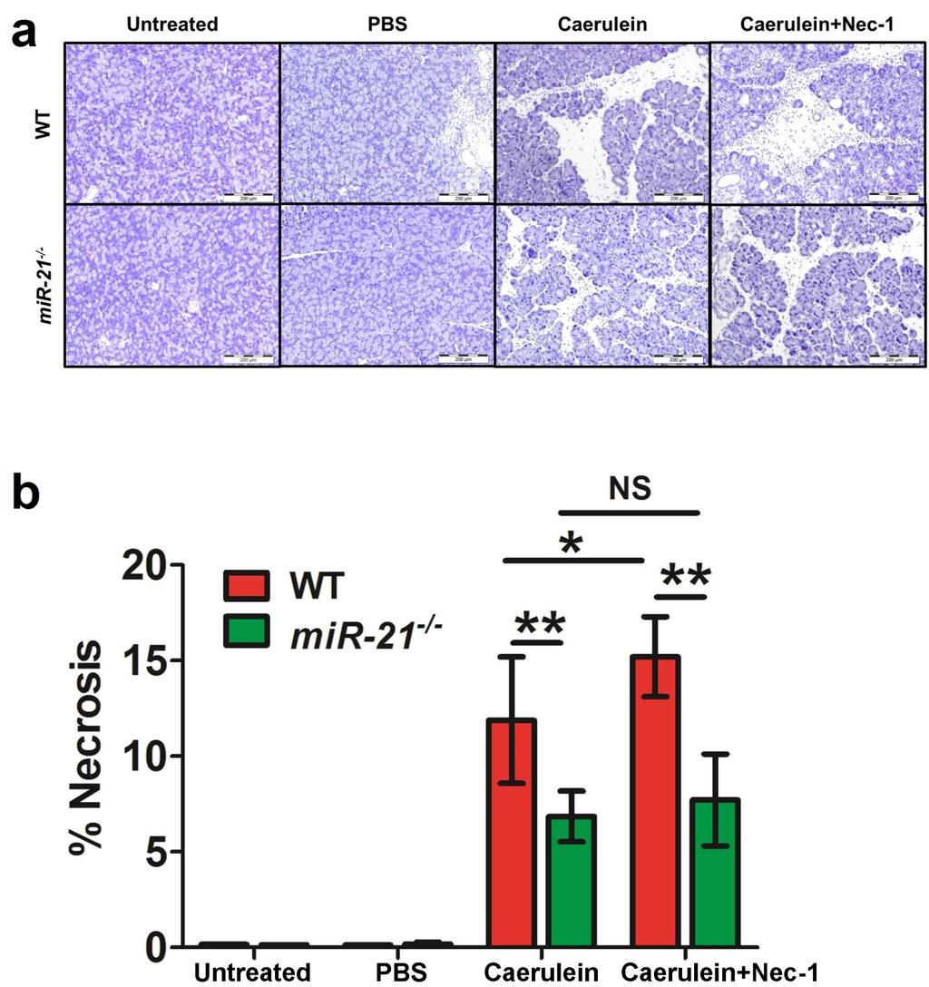 Supplementary Figure 10. The effect of necrostatin-1 on caerulein-induced pancreatitis in WT and mir-21 -/- mice.