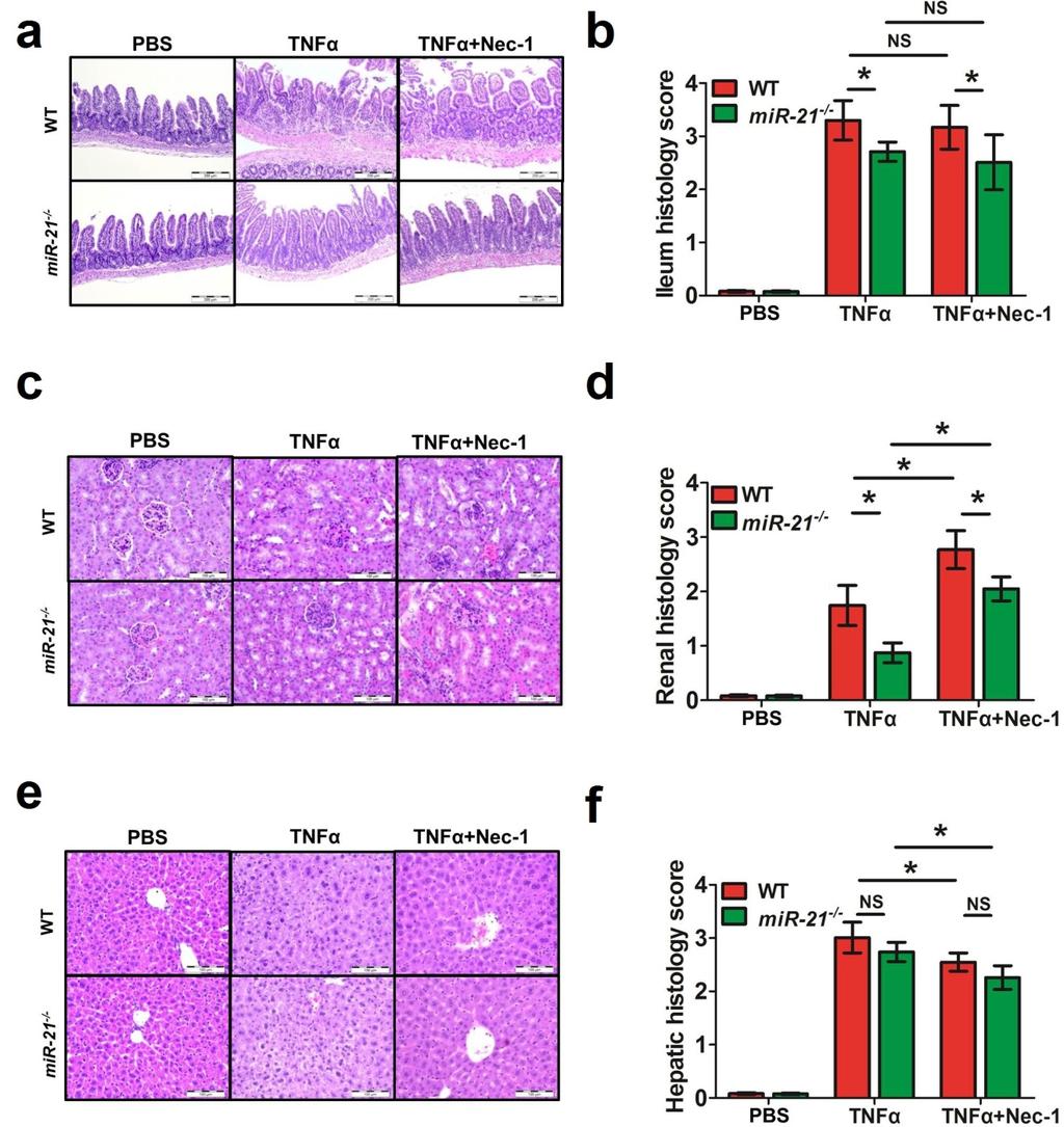 Supplementary Figure 11. The effect of necrostatin-1 on TNFα-induced shock in WT and mir-21 -/- mice.
