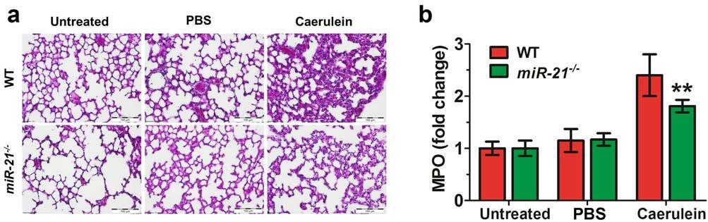 Supplementary Figure 2. Knockout of mir-21 protects pancreatitisassociated lung injury in mice.