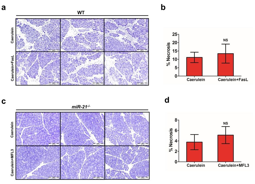 Supplementary Figure 9. The impact of FasL on caerulein-induced pancreatitis in WT or mir-21 -/- mice.