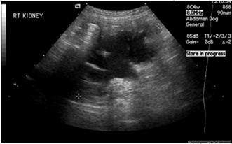 Ultrasound May