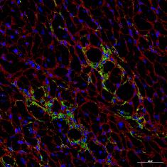 Collagen 1/3 (Red) co-staining in Tcf21 MCM ;R26