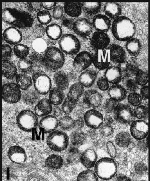 Mitochondria Human Oocyte