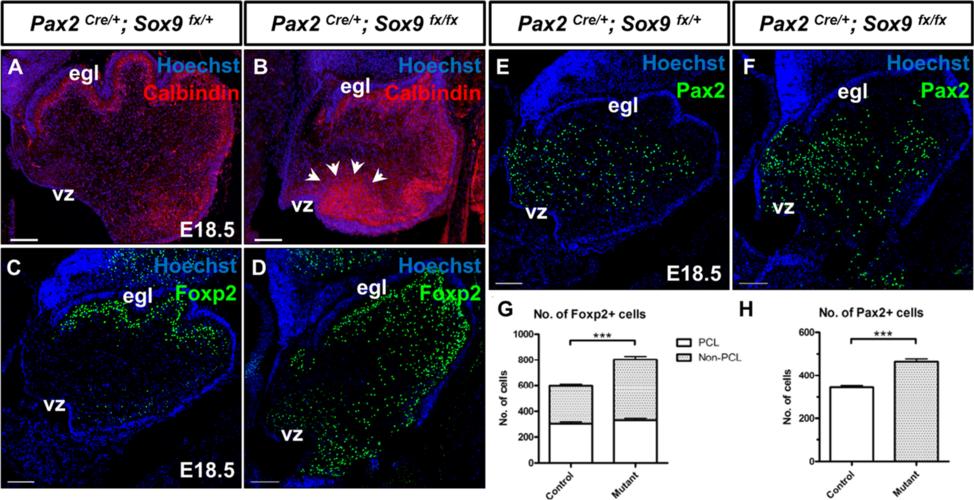 Vong et al. Molecular Brain (2015) 8:25 Page 7 of 17 we further sought to determine whether neurogenesis at the VZ was defective. Postmitotic PCs are generated from VZ between E11.5 and E13.
