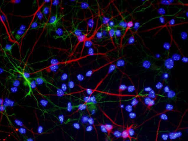 Differentiation of neural stem cells " in neurons and glia"