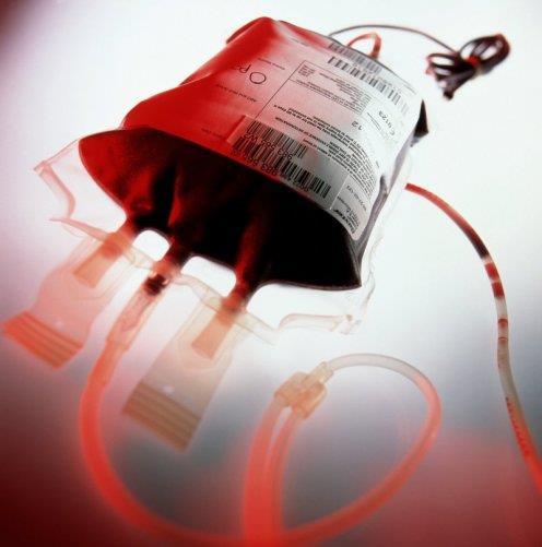 Blood Transfusion Carries Risks 85M prbcs transfused WW each year with 15M in the US alone While blood transfusion is considered safe, in the US alone there were over 65,000 transfusion reactions as