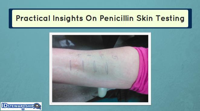 Penicillin Skin Test for type 1 hypersensitivity Penicillin allergy: 10% state they have penicillin allergy. 90% of these do not.