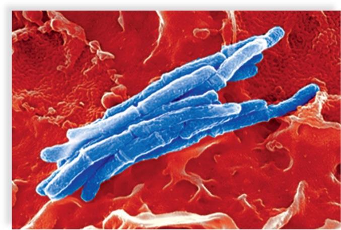 Tuberculosis An estimated 1/3 of the world s population has been exposed to TB. Approximately 8.6 million people are infected and 1.3 million people die each year.