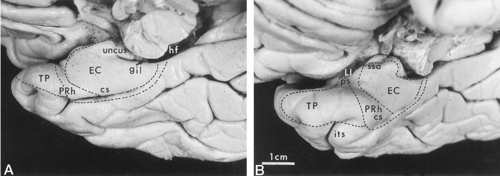 660 INSAUSTI AJNR: 19, April 1998 FIG 1. Views of the ventral aspect of the brain show location of entorhinal, perirhinal, and temporopolar cortices.