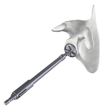 Central and peripheral reamers must be used with 39 mm and 42 mm spheres during glenoid preparation. c) Using the Articulated Driver 1.