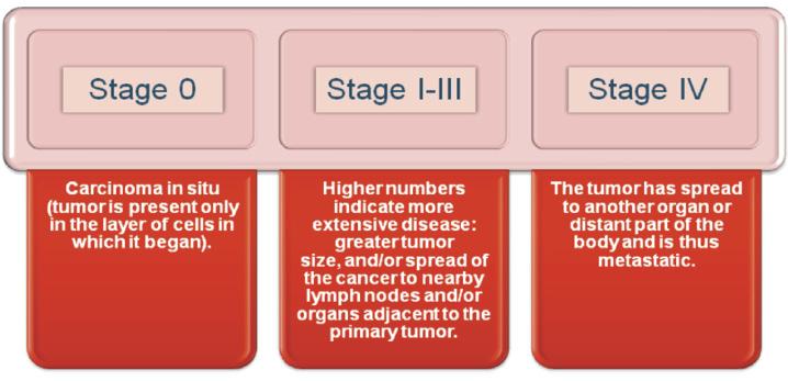 Treatment challenges Cancer staging - One system or many? In order to determine the proper treatment for cancer, it is critical to assess the extent of the disease.