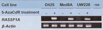 J. C. Lindsey, et al. Fig. 4. Reversal of methylation-dependent transcriptional silencing of RASSF1A in medulloblastoma cell lines by 5-AzaCdR treatment.