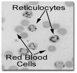 Reticulocytes Immature cells