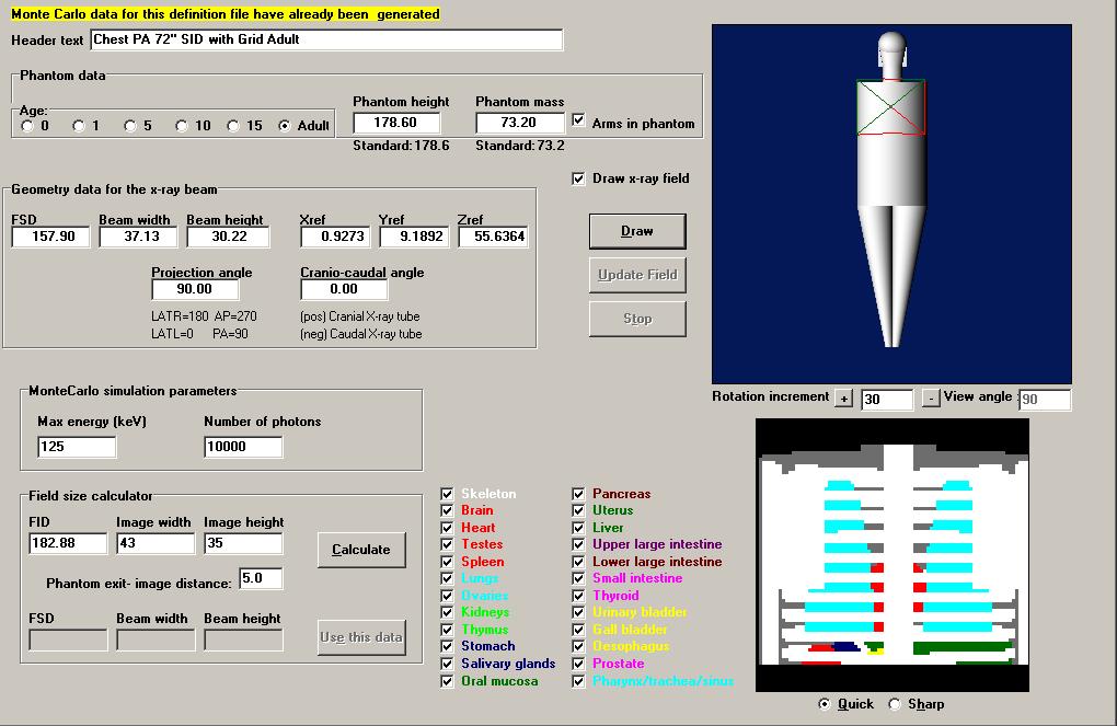 34 Figure 2.2 The main PCXMC 2.0.1 input window. This input window used for the calculation of range and effective doses from conventional radiography.