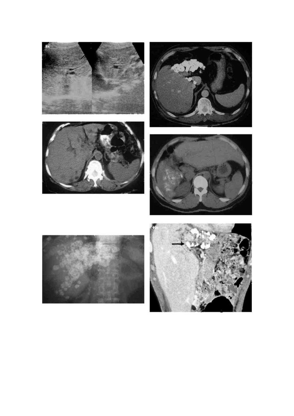 Singapore Med J 2010, 51(9) 747 10a et. 12-8b 1 106 11 Fig. 8 A middle-aged woman presented with nonspecific symptoms of fever, weight loss and sweating.