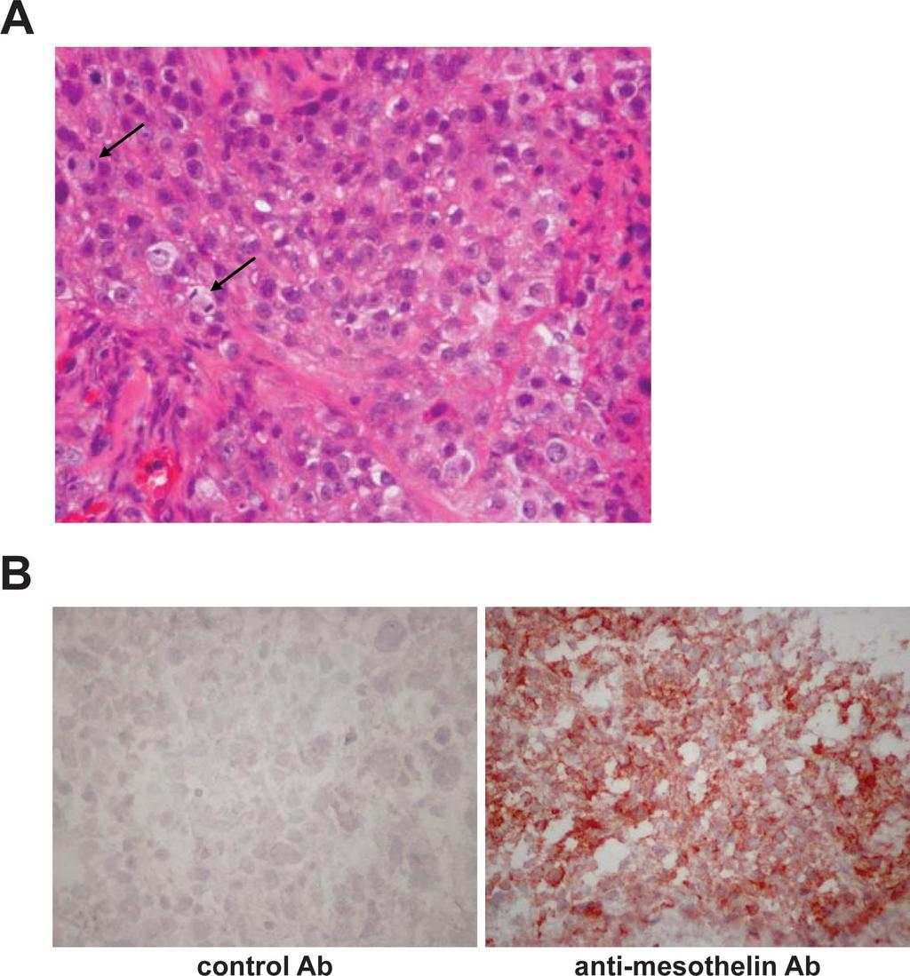 Fig. S4. In vivo mesothelin expression on M108 tumor xenograft. (A) M108 tumors were grown in NOG mice for 80 days, until they reached a volume of 2,000 mm 3, at which point the mice were killed.