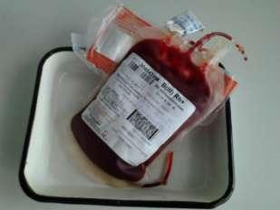 Whole blood and General surgery department of SGMU Blood components Whole blood Transfusion of whole blood can lead