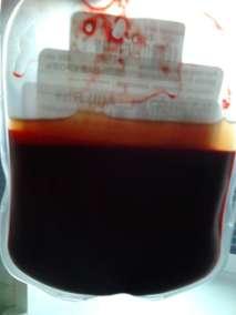 Whole blood and General surgery department of SGMU Blood components Whole blood Blood components Red