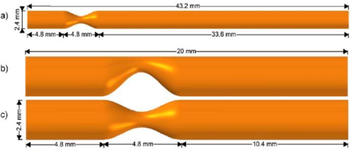 Figure 15 shows wall shear stress increases and resistance to flow decreases as stenosis size increases. inlet boundary condition for the 8 FSI simulations.