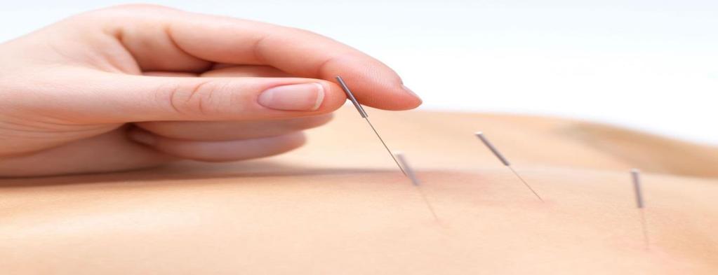 Acupuncture In trial of acupuncture in female recurrent UTI, 67 pts received real acupuncture, sham acupuncture, or no treatment twice weekly for 4 weeks.