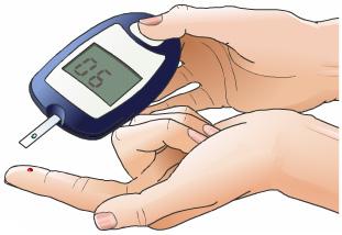 There is a higher chance of developing complications of high blood pressure if the patient has other medical conditions, such as: Diabetes. High cholesterol. Obesity.