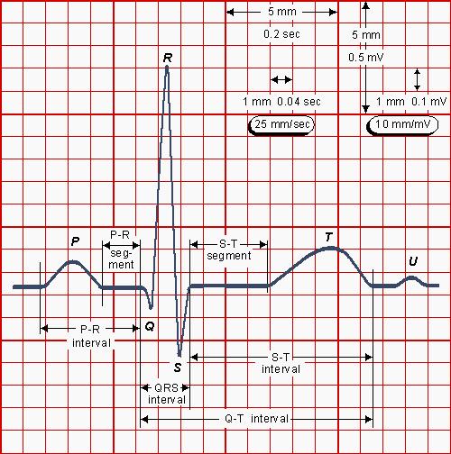 The normal electrocardiogram Waves: P wave A depolarization QRS complex V depolarization q or Q first negative wave R or r first positive