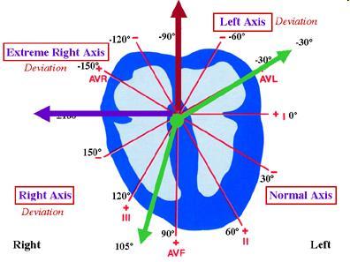 Electrical axis in the frontal plane Definition, relation with anatomical axis, deviations Extreme RAD