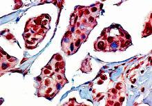 py97- in human non-tnbc tissue