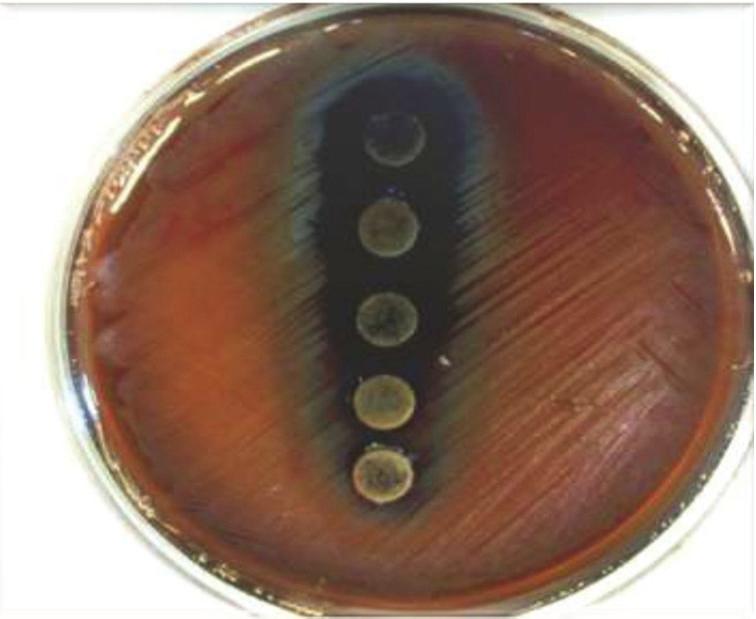 References Figure 3: The effects of ethanolic extracts of Juglans regia bark against S. sanguis. Streptococcus salivarius, Lactobacillus casei, andactinomyces viscosus)bywalnutaqueousextract[26].