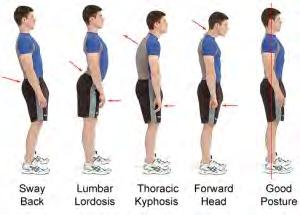 POSTURE TYPES THINK ABOUT POSITION OF PELVIS, SHOULDER GIRDLE, HEAD AND HANDS