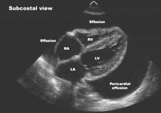 is an excellent window The heart motion can be seen in the pericardial fluid 67 68 Pedi