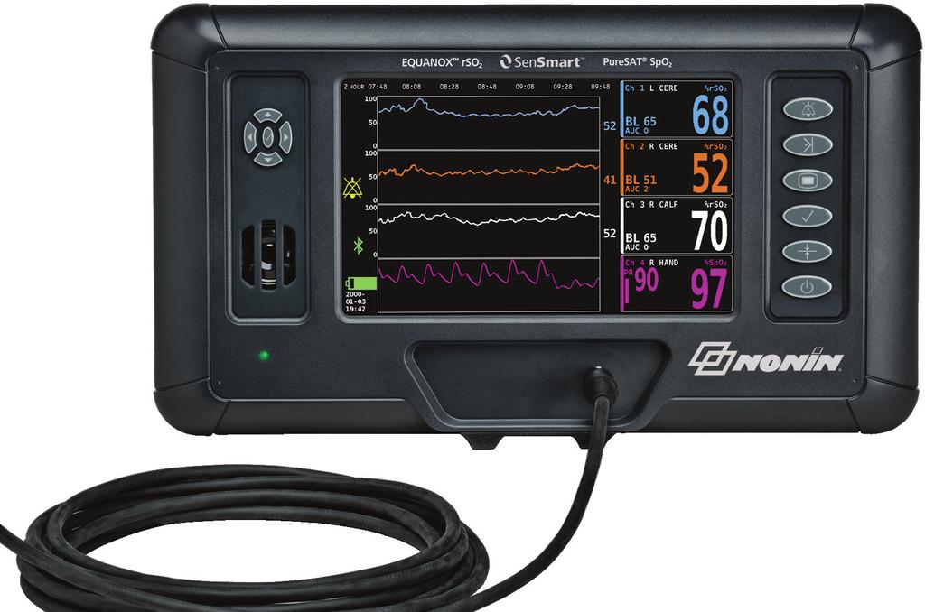 Introducing Nonin s SenSmart Universal Oximetry (rso 2 /SpO 2 ) System: Where advanced clinical utility meets unprecedented ease of use One test drive with the world s first universal oximetry system