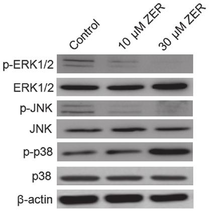 7608 LV et al: ZERUMBONE SUPPRESSES HEPATOMA VIA THE MAPK SIGNALING PATHWAY Figure 5. Zerumbone downregulates the expression levels of FAK, RhoA, ROCK 1, MMP2 and MMP9 in HepG2 cells.