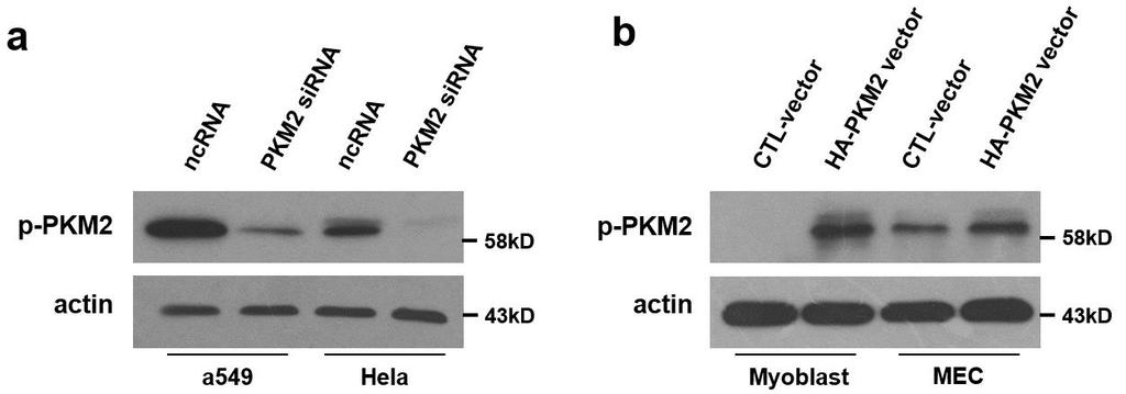 Supplementary Figure 2. Phosphorylated PKM2 (p-pkm2) levels in tumor or non-tumor cells.
