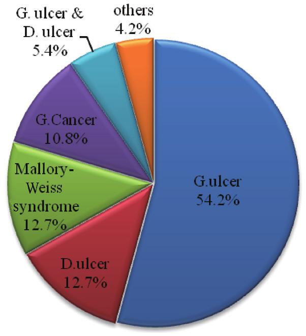 When ruled out the variceal bleeding, the portions of causes were gastric ulcer (64%), duodenal ulcer (20%), Mallory-Weiss syndrome (4%), gastric and duodenal ulcer (4%), etc (Fig. 2).