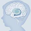 How Trauma Affects the Brain Experiences Build Brain Architecture Serve & Return