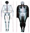 DEXA ESTIMATION Lean body mass - LBM (structural and functional elements in cells, body water, muscle, bone, heart, liver, kidneys, etc.).