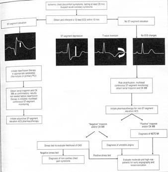 artery thrombus due to a plaque rupture ACS is categorized via the ECG changes seen NSTEMI is different than UA in that the ischemia was bad enough to cause necrosis leading to myocite release of