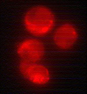 Intracellular localization of the fluorescent Magic Red product was detected on a Nikon Eclipse E800 photomicroscope using a 510-560 nm excitation filter and a 570-620 nm emission / barrier filter
