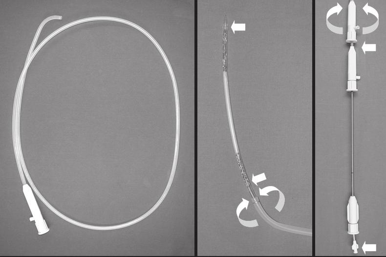 Song et al. of forward movement secondary to buckling of the stent delivery system on its way to the area of obstruction (6, 7).