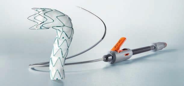 Stent Graft SOLUTIONS