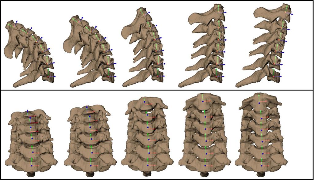 Figure 3: Three-dimensional bone models at five instants of the flexion cycle.