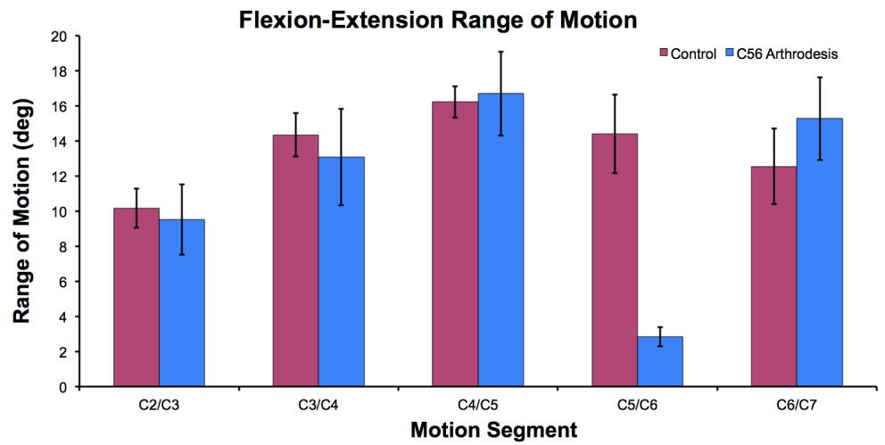 Figure 12: Average range of motion at each motion segment. 2.3.