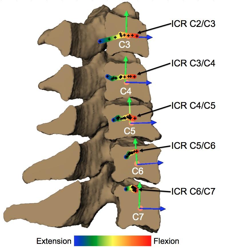 Figure 20: ICR path during