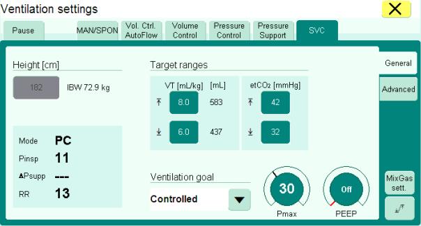 Smart Ventilation Control: User Interface Main Parameters Height: Needed for IBW as Smart Ventilation Control operates with VT in ml/kg Target Ranges: VT in ml/kg and etco2 Ranges predefined for
