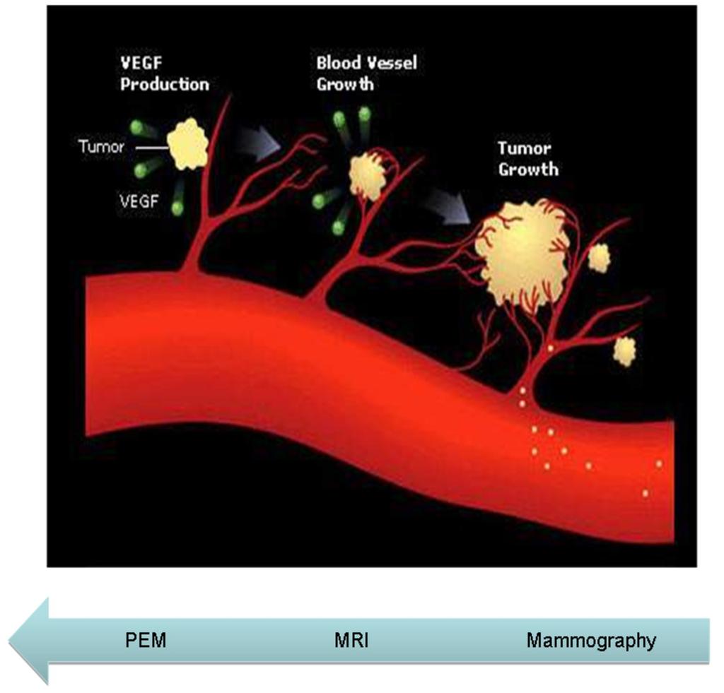 Fig. 1: Concept of PEM: Molecular imaging has the advantage of not being dependent on capillary angiogenesis 18-Flurodeoxyglucose (FDG) can diffuse into the interstitial space and be