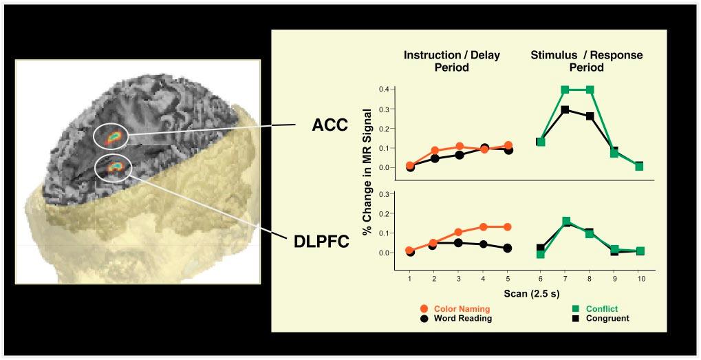 Figure 5 Time course of fmri activity in dorsolateral prefrontal cortex (DLPFC) and anterior cingulate cortex (ACC) during two phases of a trial in the instructed Stroop task.