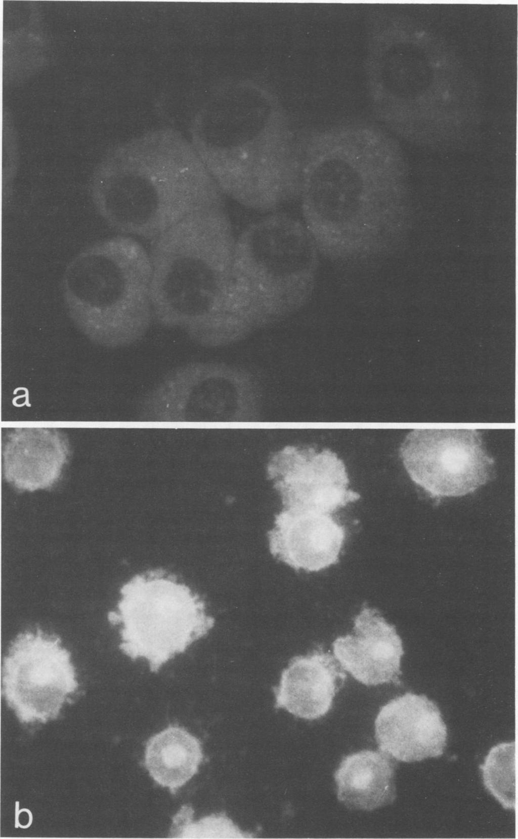 VOL. 31, 1981 INFLUENZA VIRUS-MOUSE MACROPHAGE INTERACTION 755 FIG. 4. Immunofluorescent staining of alveolar macrophages infected with Kunz influenza virus.