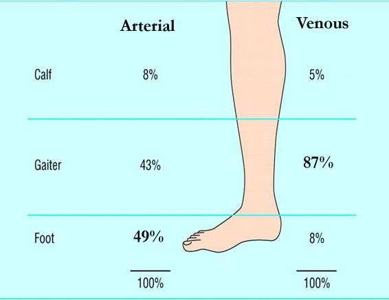 Clinical disease Arterial vs Venous: Ulcer Location Arterial wounds Diabetes mellitus Neuropathy Sensory Motor Autonomic
