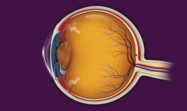 Fluid flowing into the eye Iris (colored part of eye) Cornea (clear front cover of eye) Pathway for f luid to drain Lens Angle where the canals are located (canals are where f luid drains) Ciliary